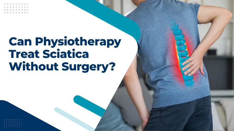 Can Physiotherapy Treat Sciatica Without Surgery