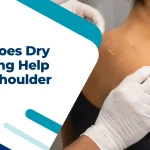 How Does Dry Needling Help With Shoulder Pain