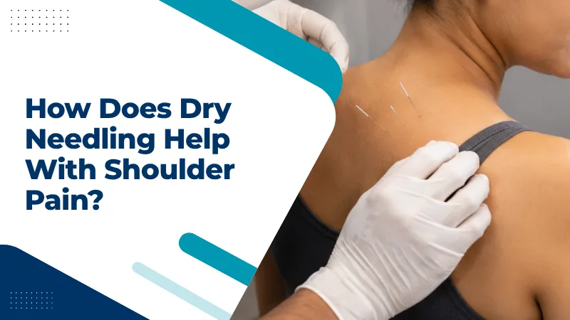 How Does Dry Needling Help With Shoulder Pain