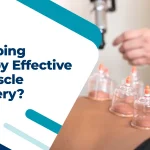 Is Cupping Therapy Effective for Muscle Recovery
