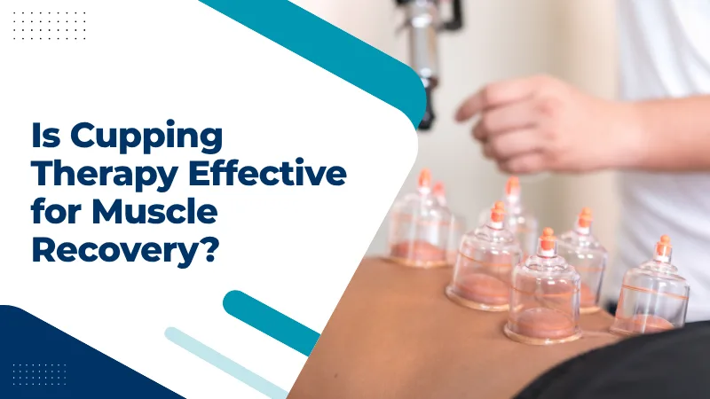 Is Cupping Therapy Effective for Muscle Recovery